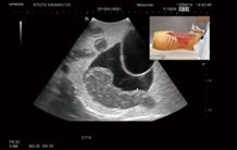 Zdjęcie Fantom do USG ciąży