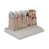 Model zębów, 4xpowiększenie