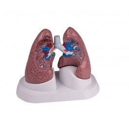 Zdjęcie Model płuc z patologiami