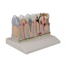 Zdjęcie Model zębów, 4xpowiększenie