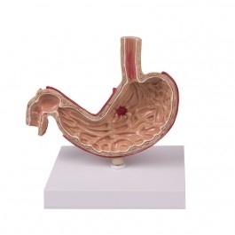 Zdjęcie Model żołądka